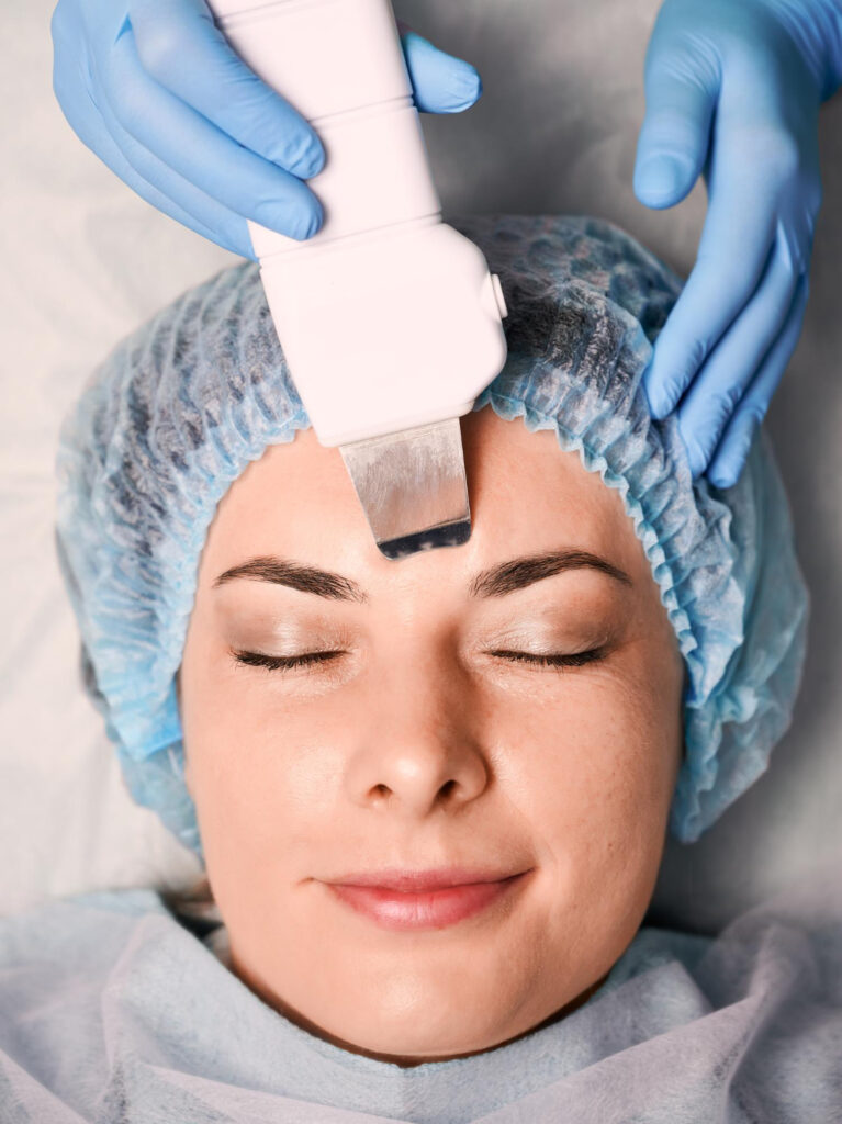The Chemical Peel Process: Day By Day