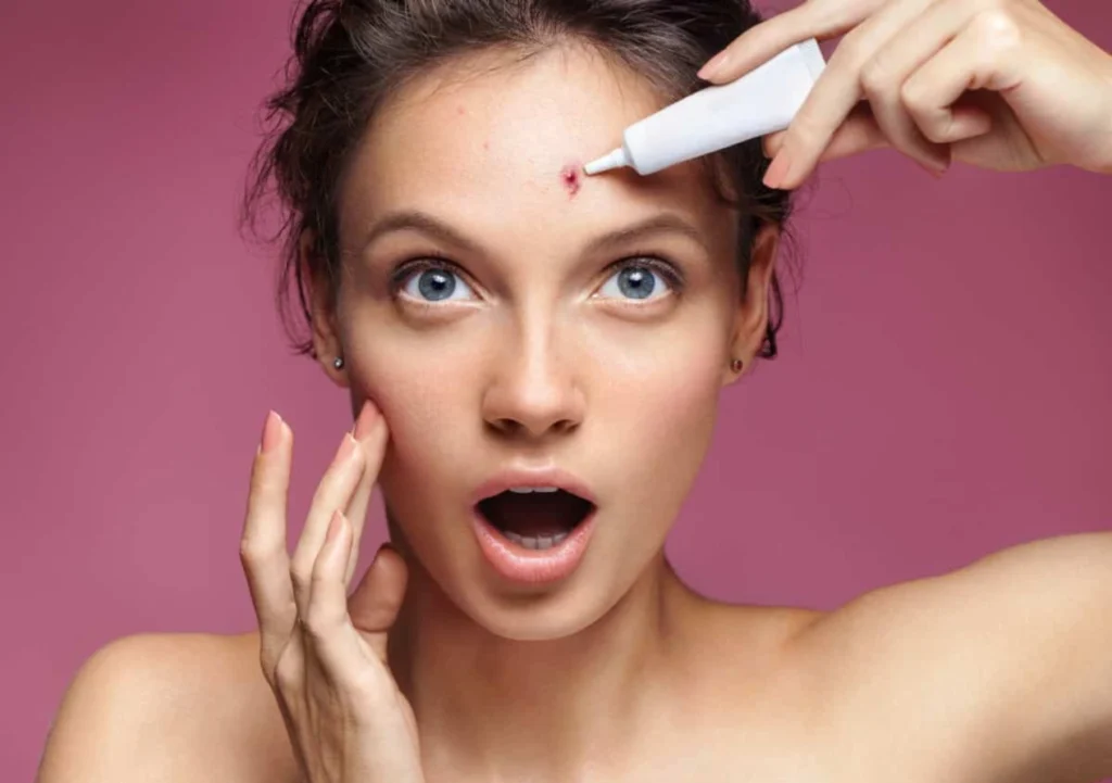 Clearing the Way: Home Remedies to Banish Acne Between Eyebrows