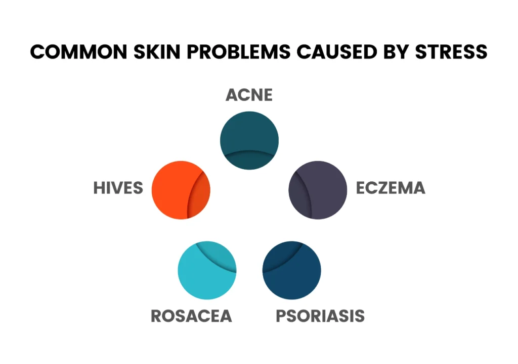 Common Skin Problems Caused by Stress Infographic