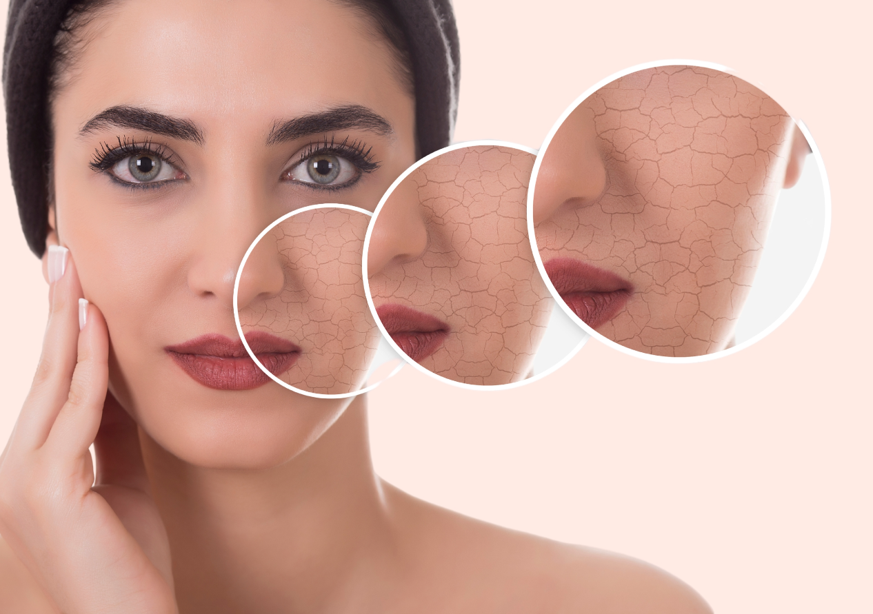 The Image is Showing Three Different Sizes of Dry Skin on a Woman's Face